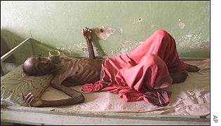 Victima de la tuberculosis en Africa